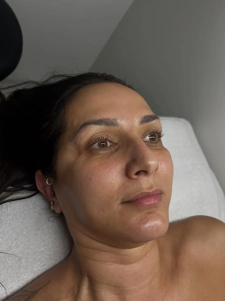 A client with fresh, glowing skin relaxing after a facial at OH! Esthetics in Sherman Oaks