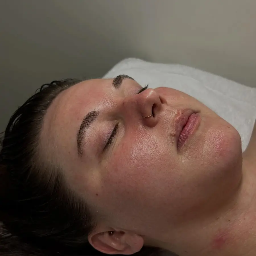 Close-up of a client's dewy, glowing skin after a results-driven facial at OH! Esthetics